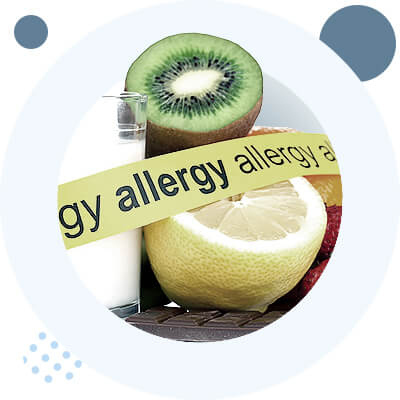 Types of allergies
